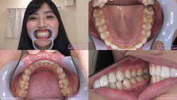 【歯フェチ】川崎亜里沙ちゃんの歯を観察しました！
