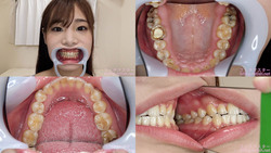 [Tooth fetish] I observed Rino Yuki&#39;s teeth!