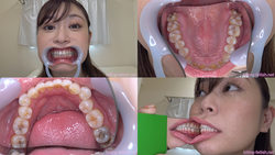 [Tooth fetish] I observed Aoi Yurika&#39;s teeth!