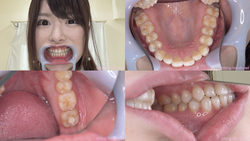 【歯フェチ】辻井ほのかちゃんの歯を観察しました！