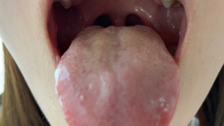 真面目そうな学生さんの舌苔は黄色味 アヤナ KITR00291