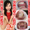 在長舌的大學生Mari-chan的齲齒治療期間被遺棄了！含口腔張開器的口腔欣賞