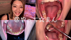 [個人射擊]實際上，觀察一個頑皮鄰居的姐姐Kanae Lennon的牙齒