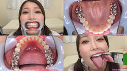 [치아 페티쉬】 사에키 由美香 씨의 치아를 관찰했습니다!