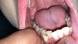 [Good news] K**** tooth beauty Wakana KITR00301 discovered after a long time