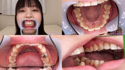 【歯フェチ】江本あやみちゃんの歯を観察しました！