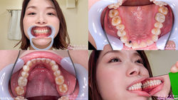 【歯フェチ】加藤ツバキさんの歯を観察しました！